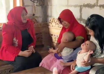 Peringati Hari Lahir Pancasila, Mbak Osel Kunjungi Bayi Kembar Penderita Hidrosefalus